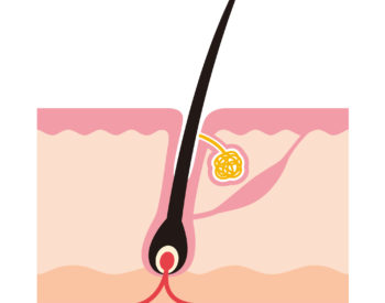 diagnostico-capilar-calvicie