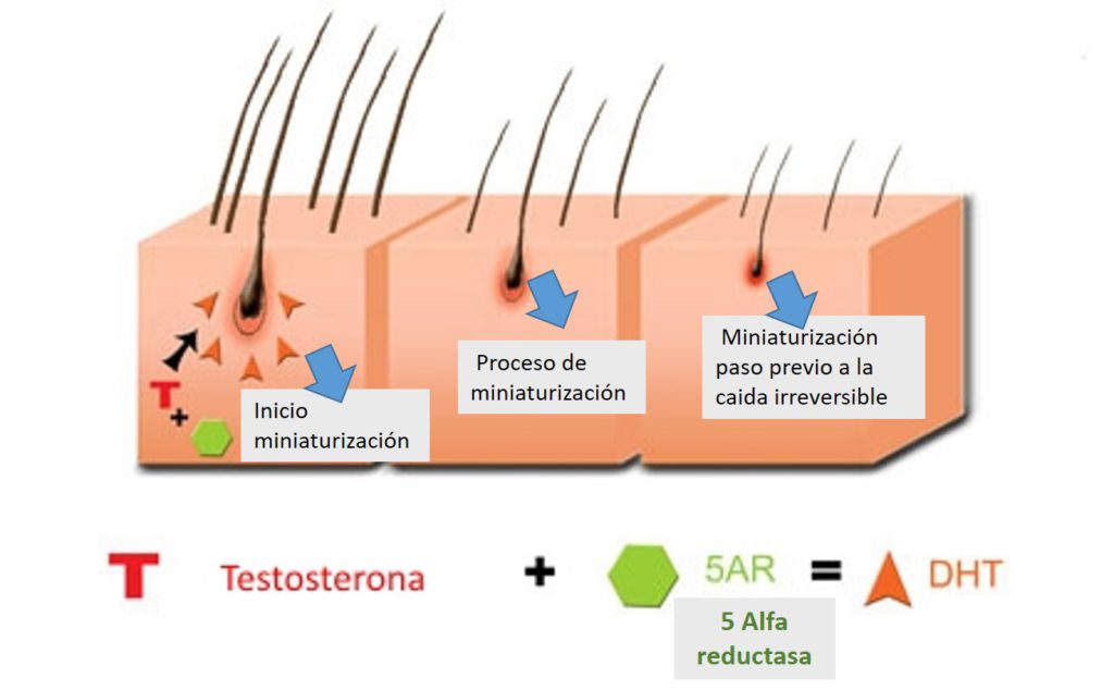 miniaturizacion-proceso-caida-cabello