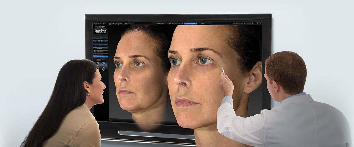 VECTRA-X3-simulación-medico-estética3D-Valencia