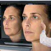 vectra3d-simulacion-operacion