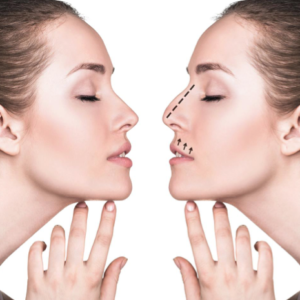 rinomodelacion-valencia