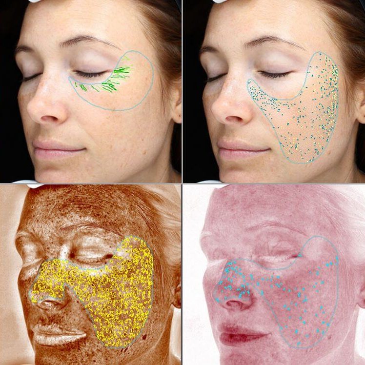 adonia-valencia-diagnostico