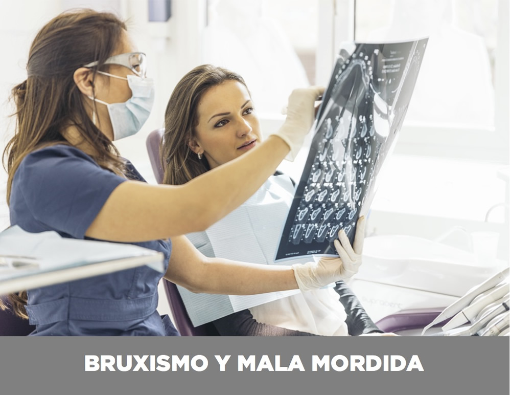 BRUXISMO BRUXISMO