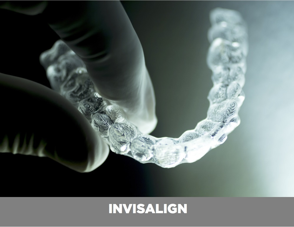 INVISALIGN ortodoncia-invisible-valencia