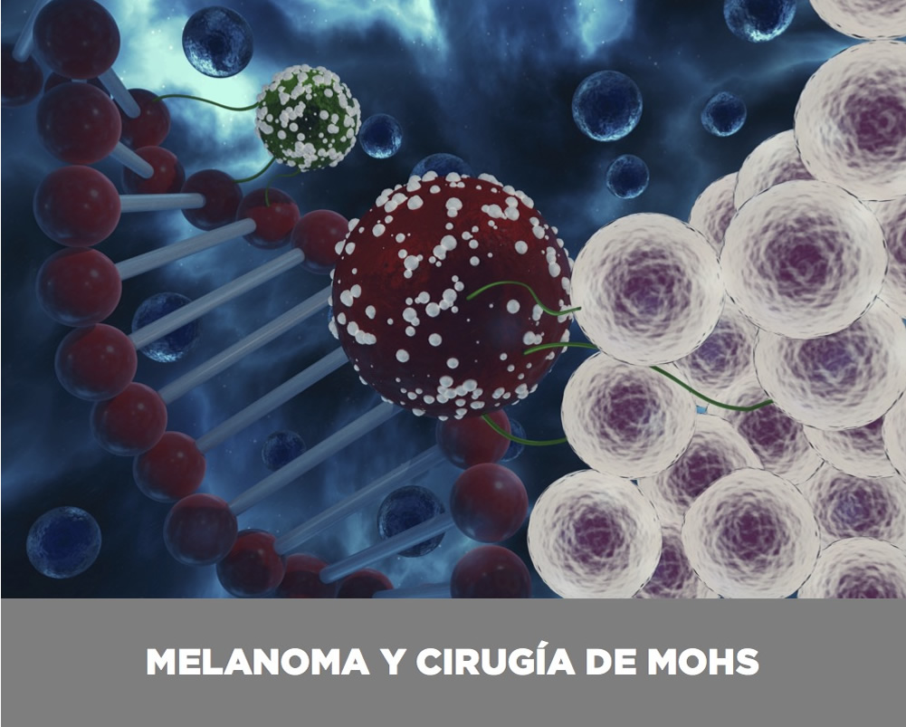 cancer-piel-valencia-melanoma