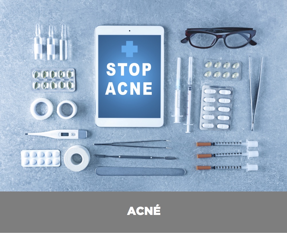 tratamiento-acne-valencia