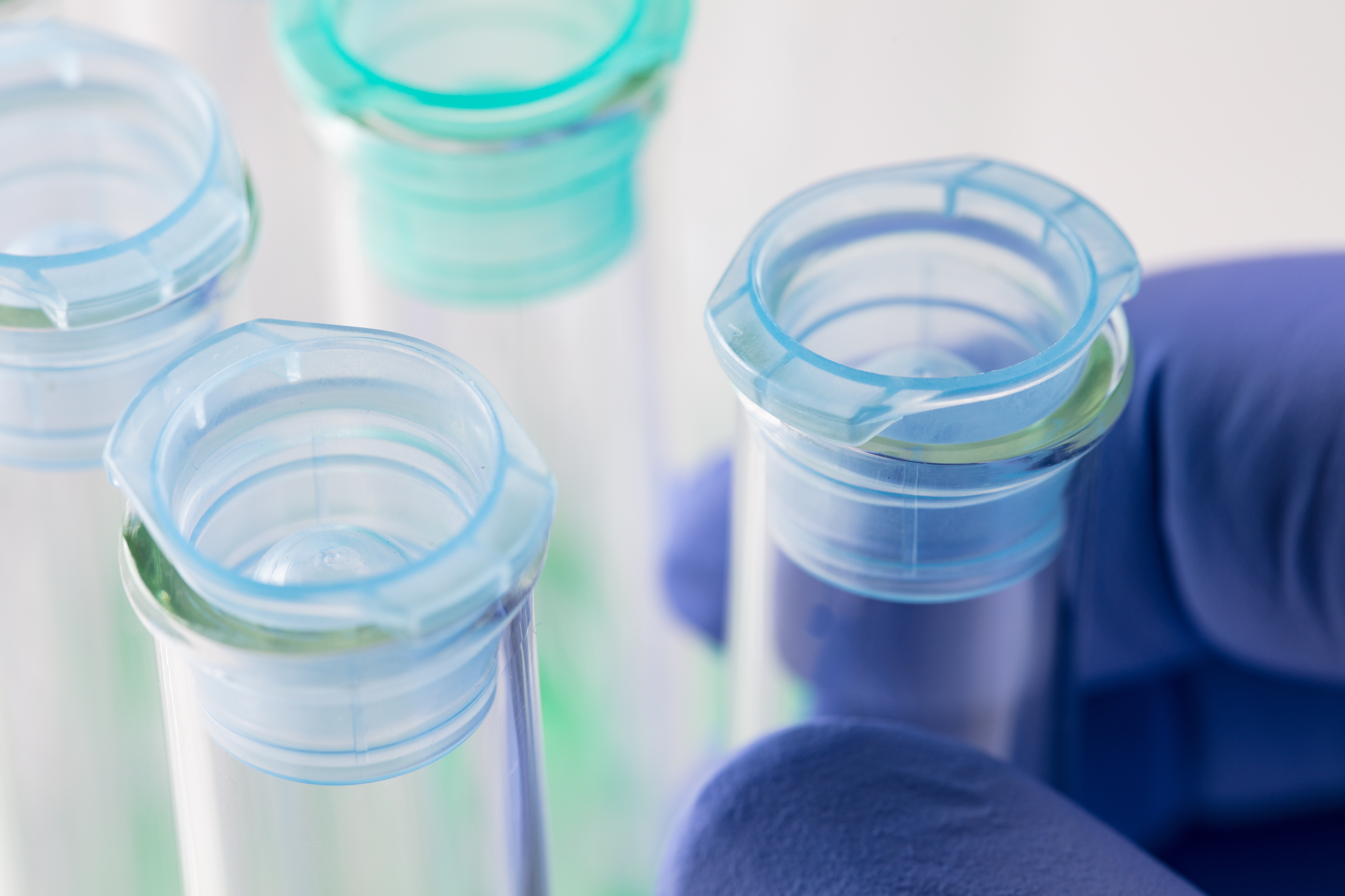 CÉLULAS MADRE alopecia