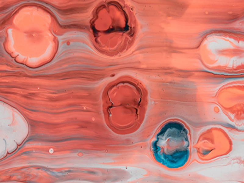 ALOPECIA CICATRICIAL CENTRAL CENTRIGUGA