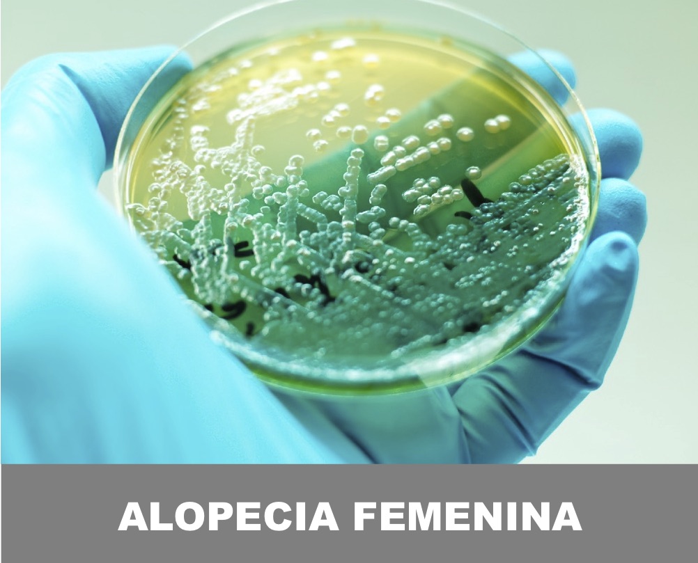 ALOPECIA FEMENINA VALENCIA