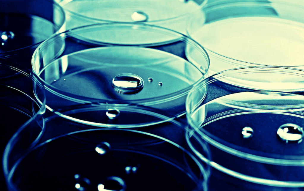 alopecia valencia femenina