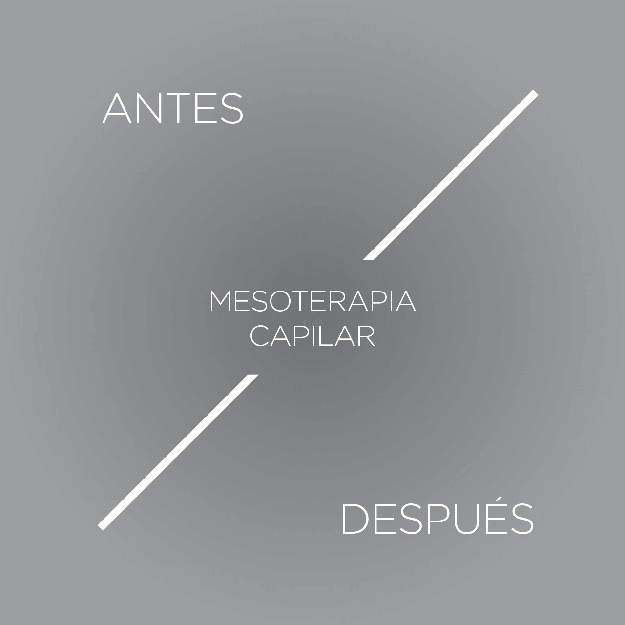 antes y despues de mesoterapia capilar