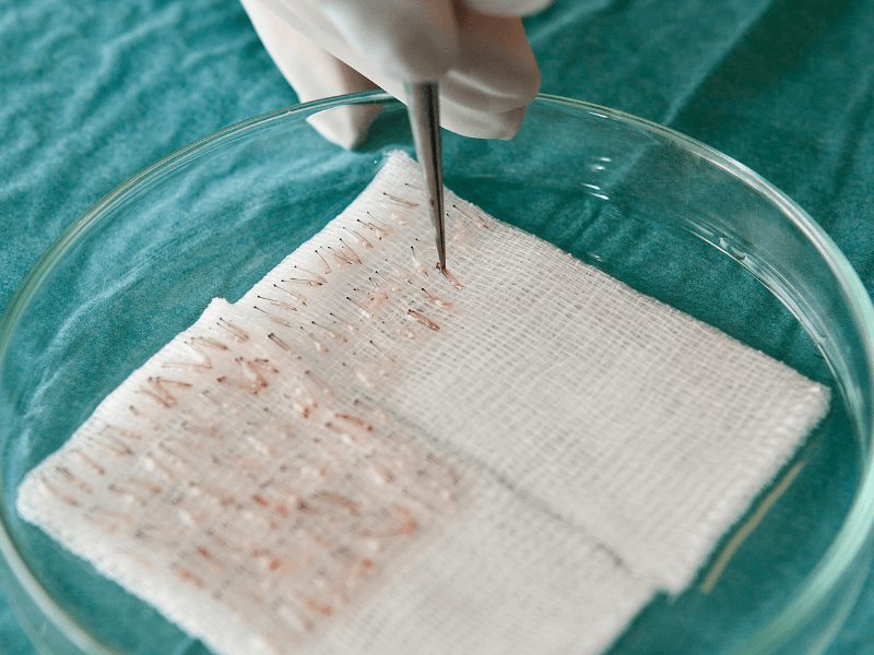 regeneracion capilar celulas madre