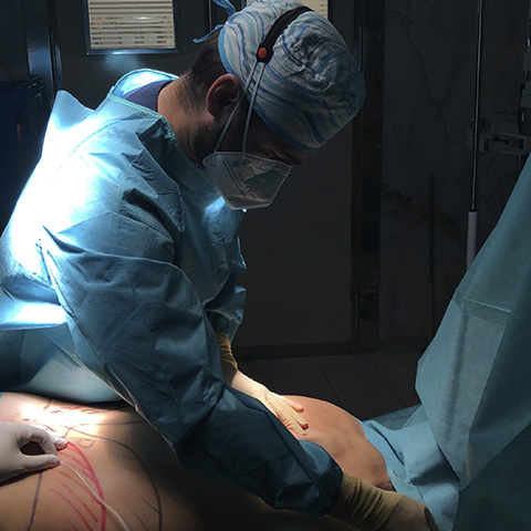 CIRUGÍA PLÁSTICA MADRID