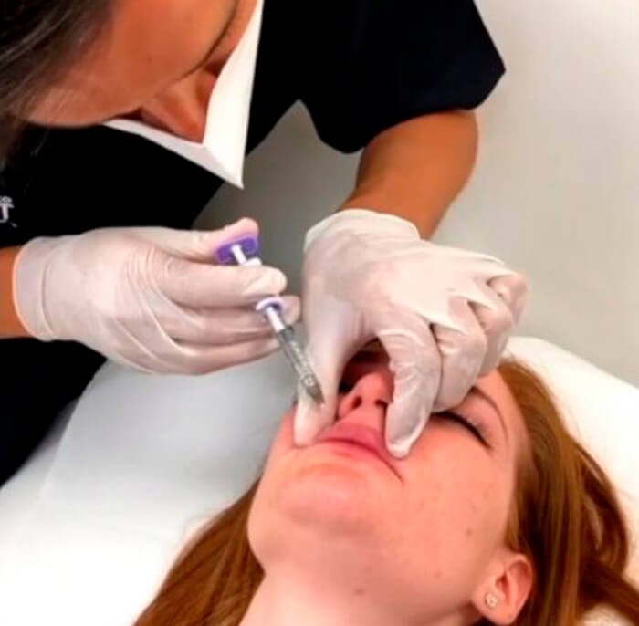 MEDICINA ESTÉTICA ALICANTE