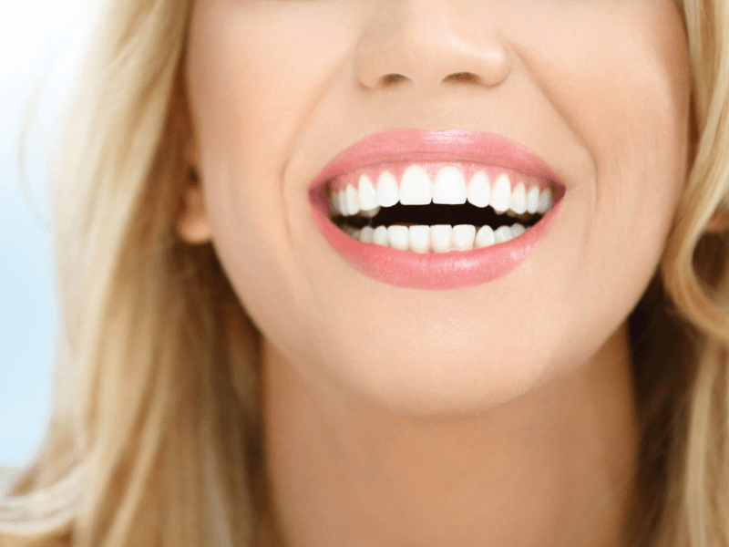 sonrisa perfecta tratamientos