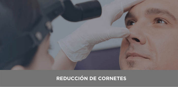 reduccion cornetes valencia