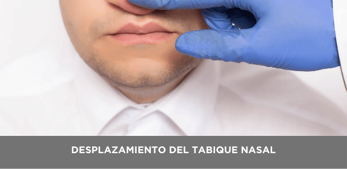 desplazamiento tabique nasal valencia