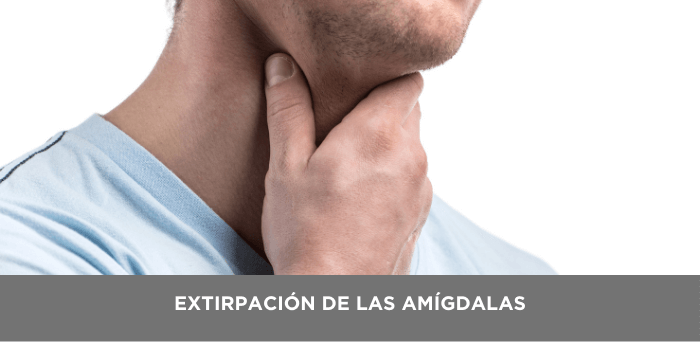 extraccion de las amigdalas