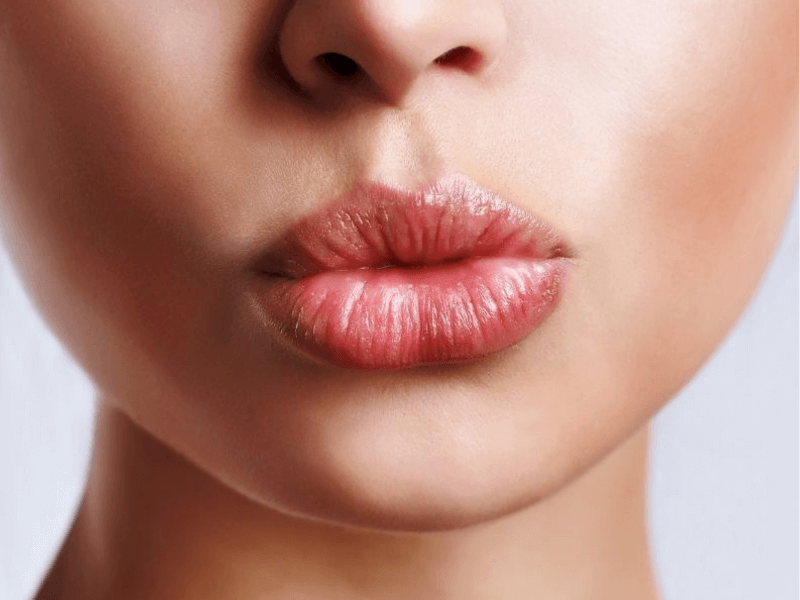 AUMENTO Y RELLENO DE LABIOS