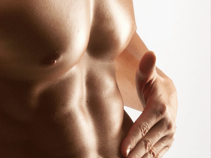 abdominoplastia RENUVION