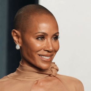 alopecia-femenina-causas