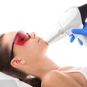 mejor-laser-facial