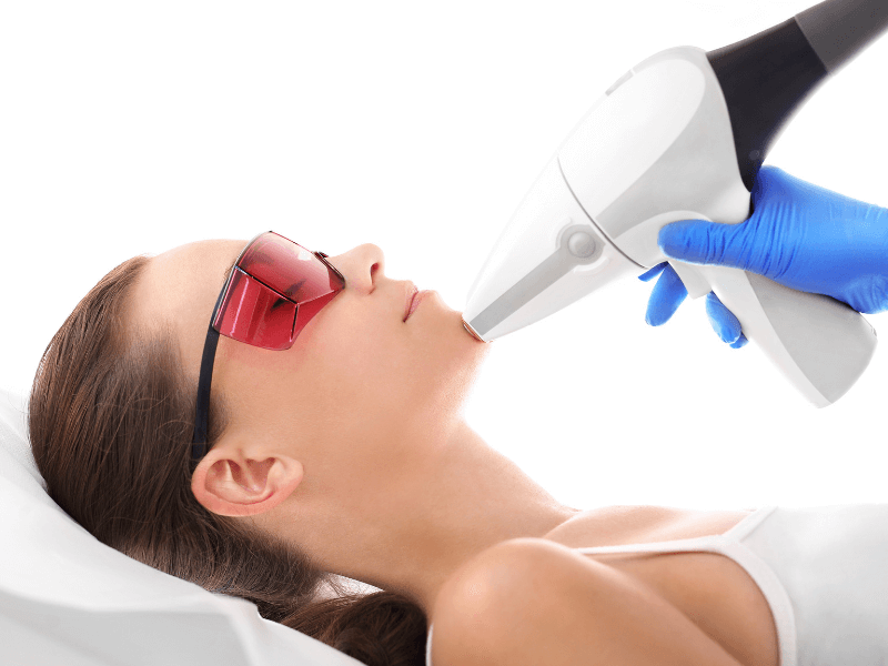 mejor-laser-facial